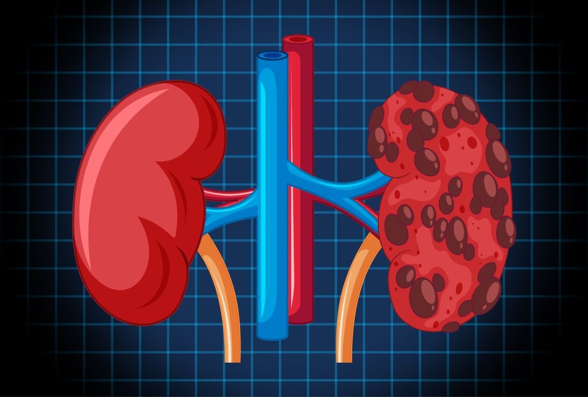 KIDNEY CURE CLINIC DIALYSIS CENTER